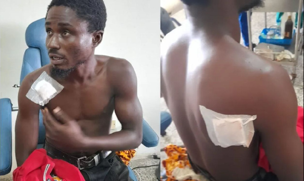 Runaway armed robber exposed with a gunshot wound 1